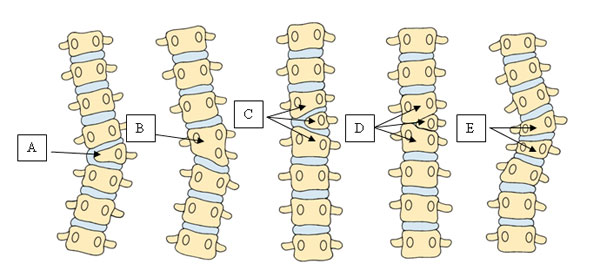 Defects of Formation