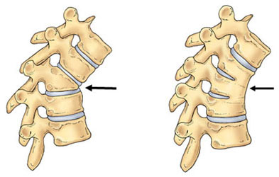 Failure of Formation deformity Right: Failure of Separation deformity