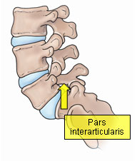 pars interarticularis